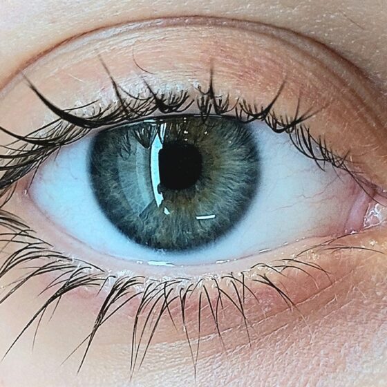 how-to-have-white-eyes-white-eye