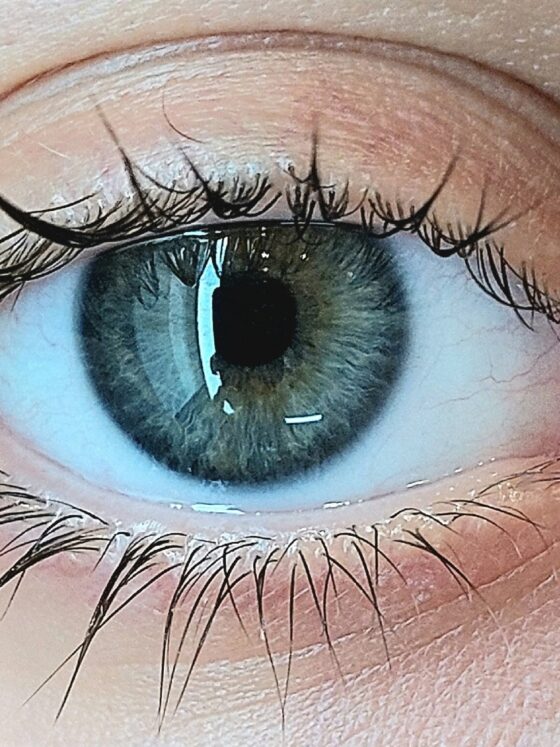 how-to-have-white-eyes-white-eye